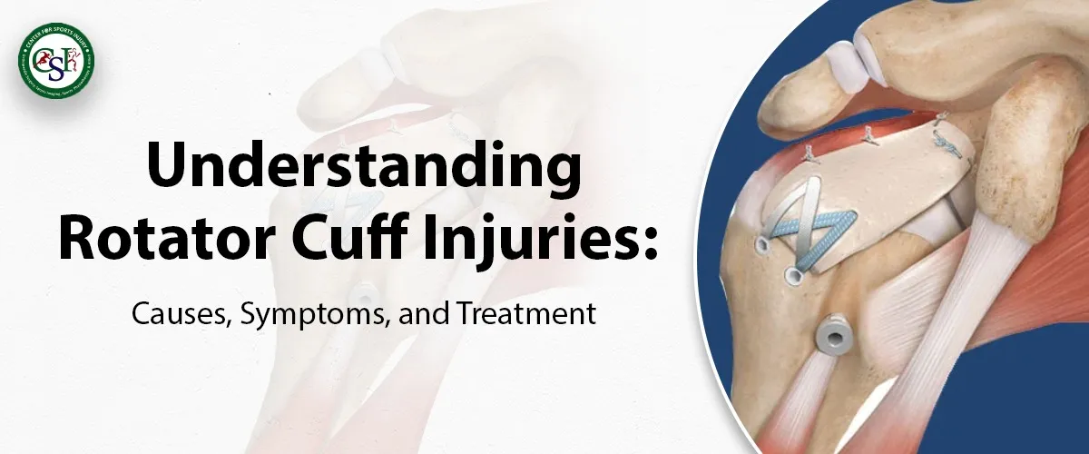 Understanding Rotator Cuff Injuries: Cause, Symptoms and Treatment