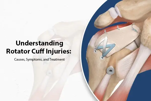 Understanding Rotator Cuff Injuries: Causes, Symptoms, and Treatment
