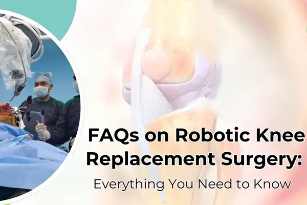 FAQs on Robotic Knee Replacement Surgery: CSI