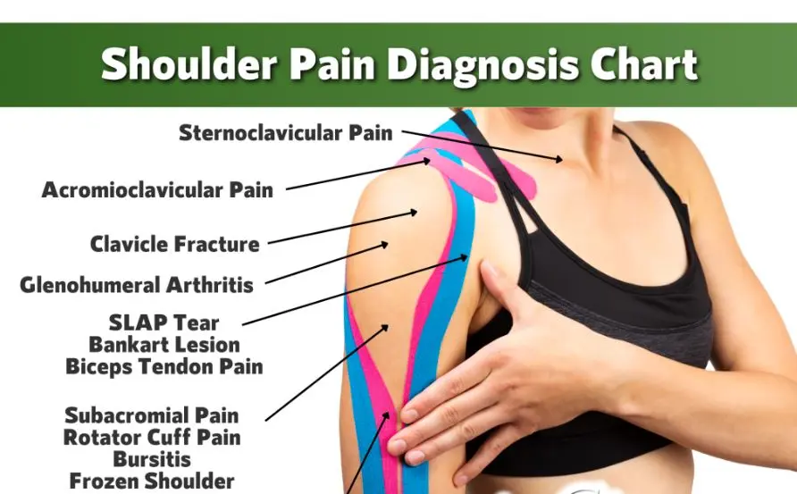 Shoulder Pain Diagnosis Chart