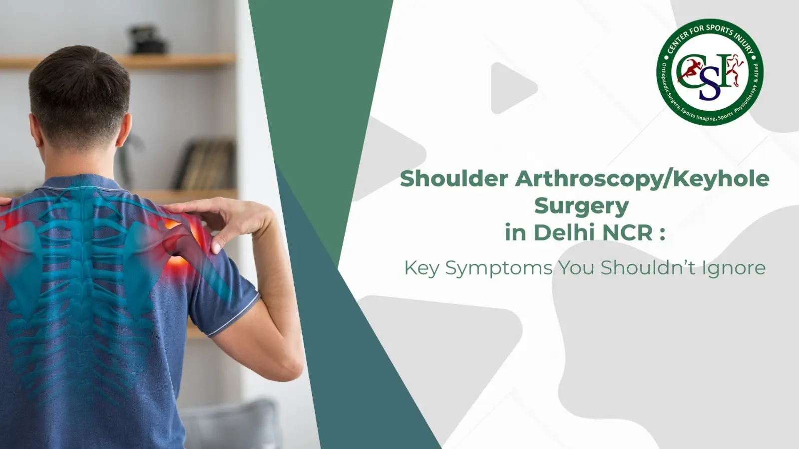 Shoulder Arthroscopy in Delhi NCR