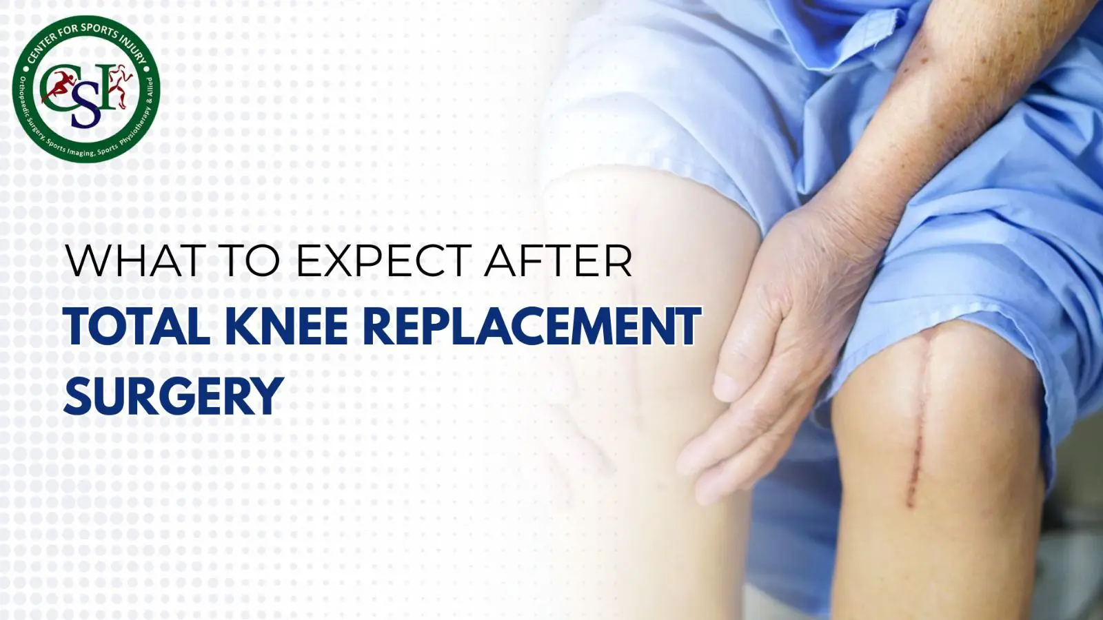 What to Expect After Knee Replacement Surgery