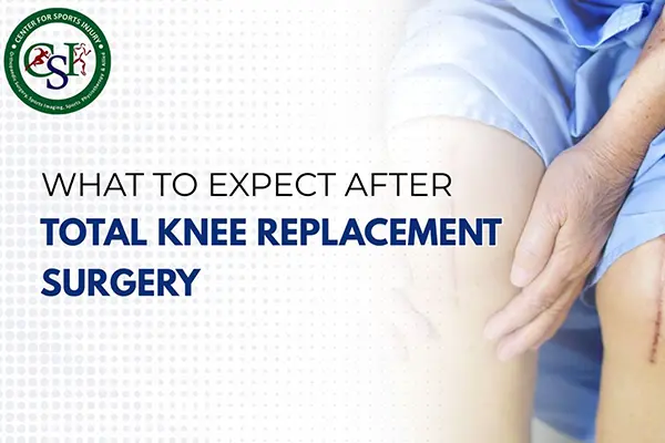 What to Expect After Knee Replacement Surgery