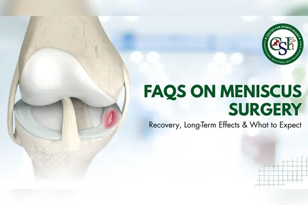 FAQs on Meniscus Surgery: Recovery, Long-Term Effects & What to Expect