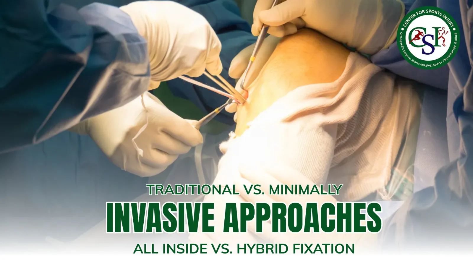 All Inside vs. Hybrid Fixation