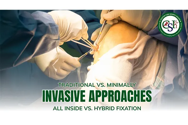 Traditional vs Minimally Invasive ACL Surgery