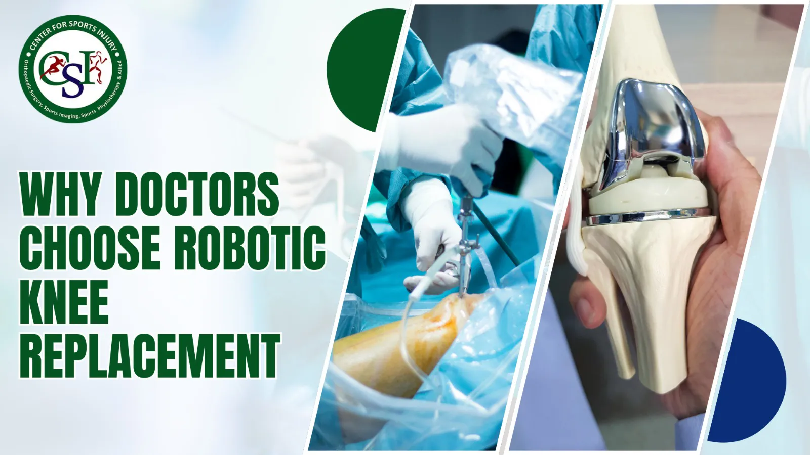 Why Doctors Choose Robotic Knee Replacement