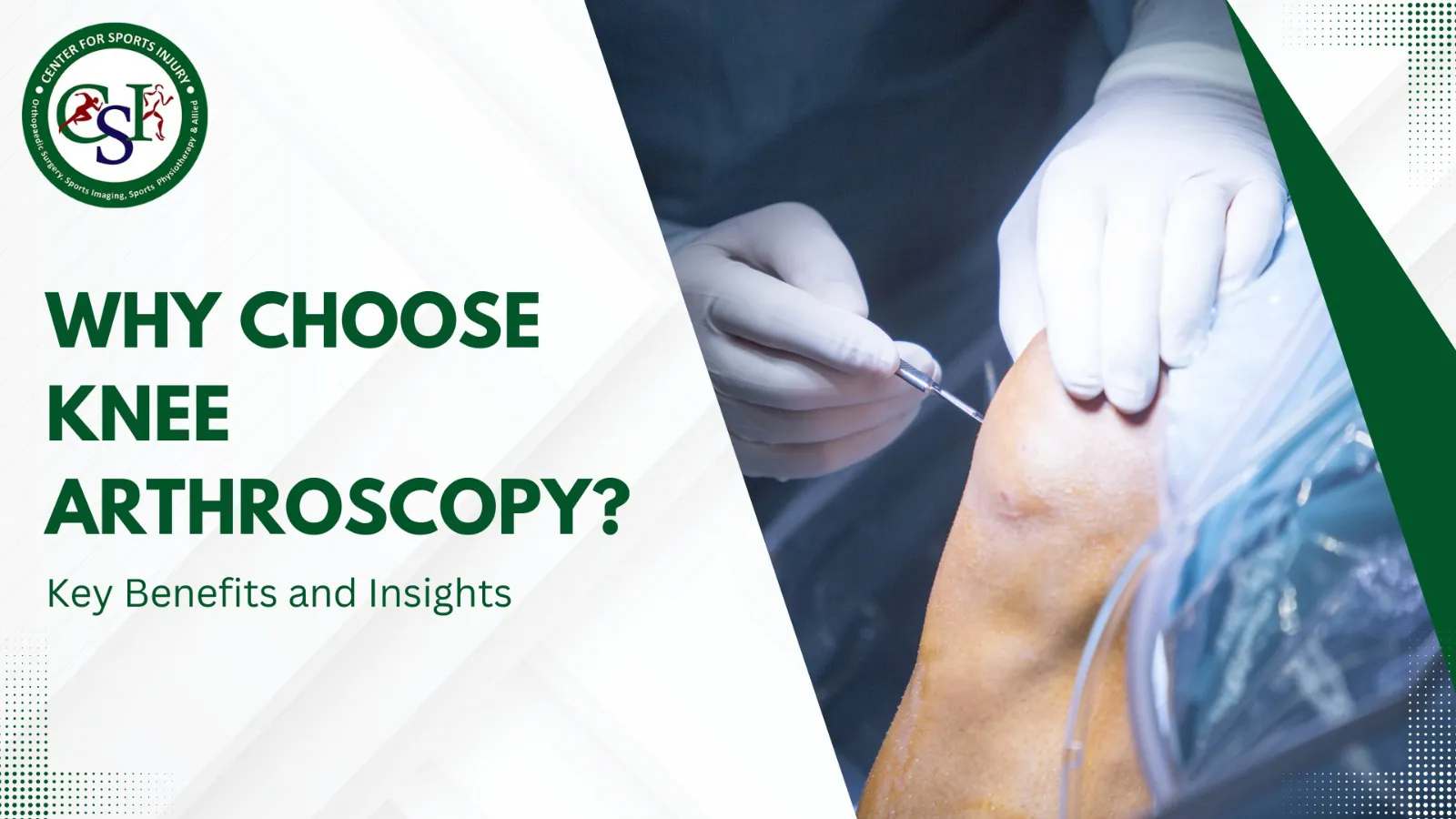 Why Choose Knee Arthroscopy? Key Benefits and Insights