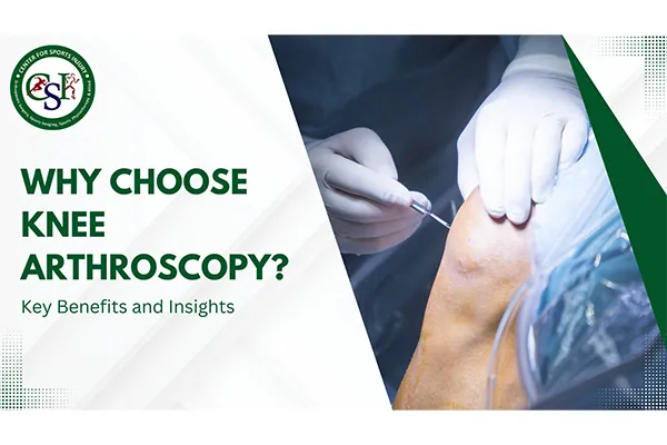 Why Choose Knee Arthroscopy? Key Benefits and Insights