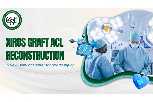 Xiros Graft ACL Reconstruction in New Delhi at Center for Sports Injury: AGame-Changer in Sports Injury Recovery
