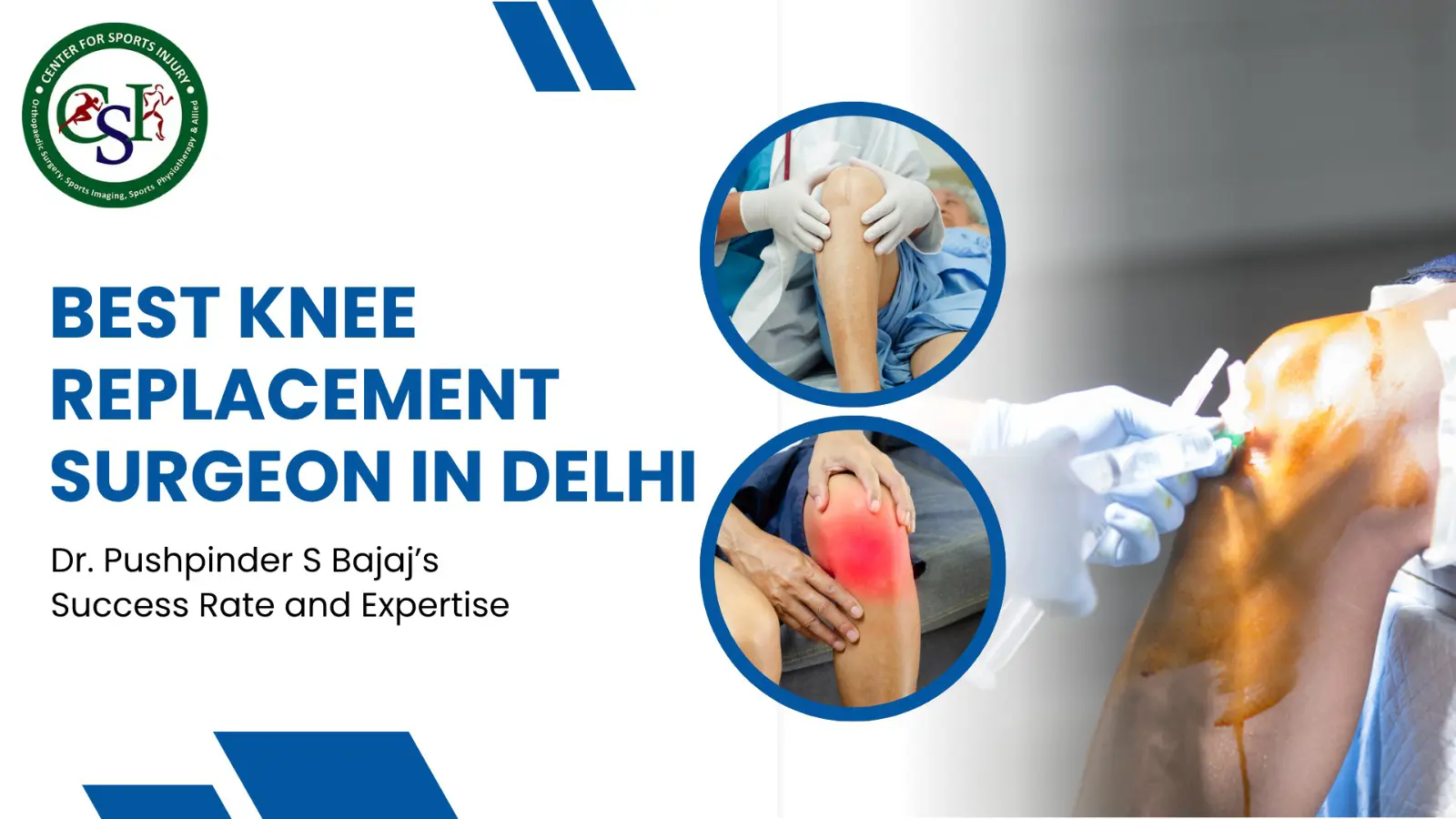 Best Knee Replacement Surgeon in Delhi Dr. Pushpinder Leading Surgeon : A Game-Changer in Sports Injury Recovery