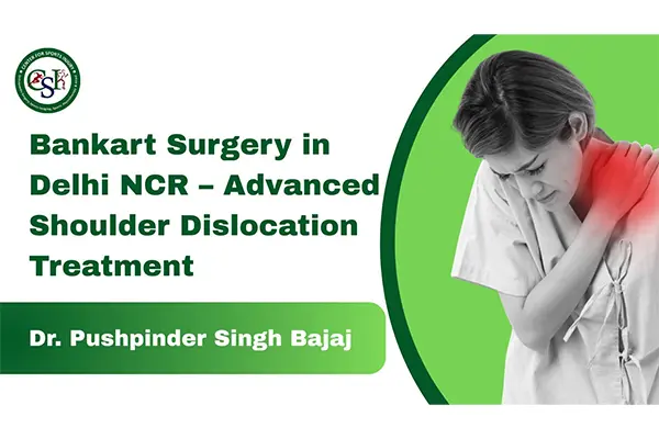Bankart Surgery in Delhi NCR – Advanced Shoulder Dislocation Treatment by Dr. Pushpinder Singh Bajaj