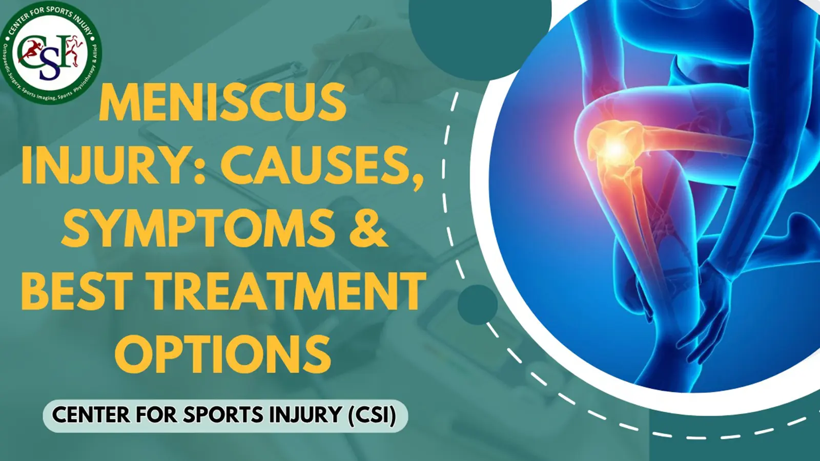 Meniscus Injury: Causes, Symptoms & Best Treatment Options