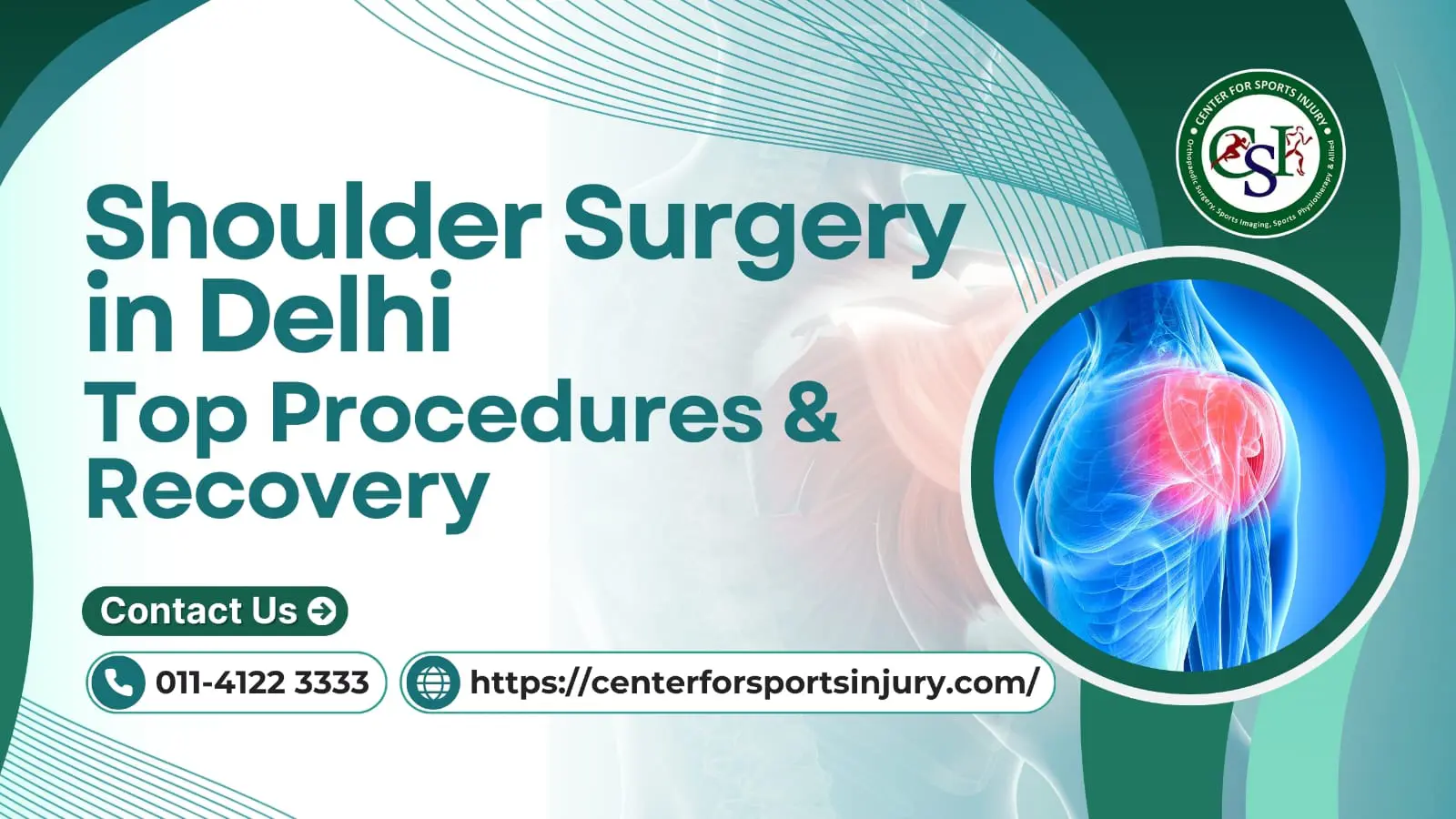 Shoulder Surgery in Delhi: Common Procedures, Recovery, and Best Hospitals