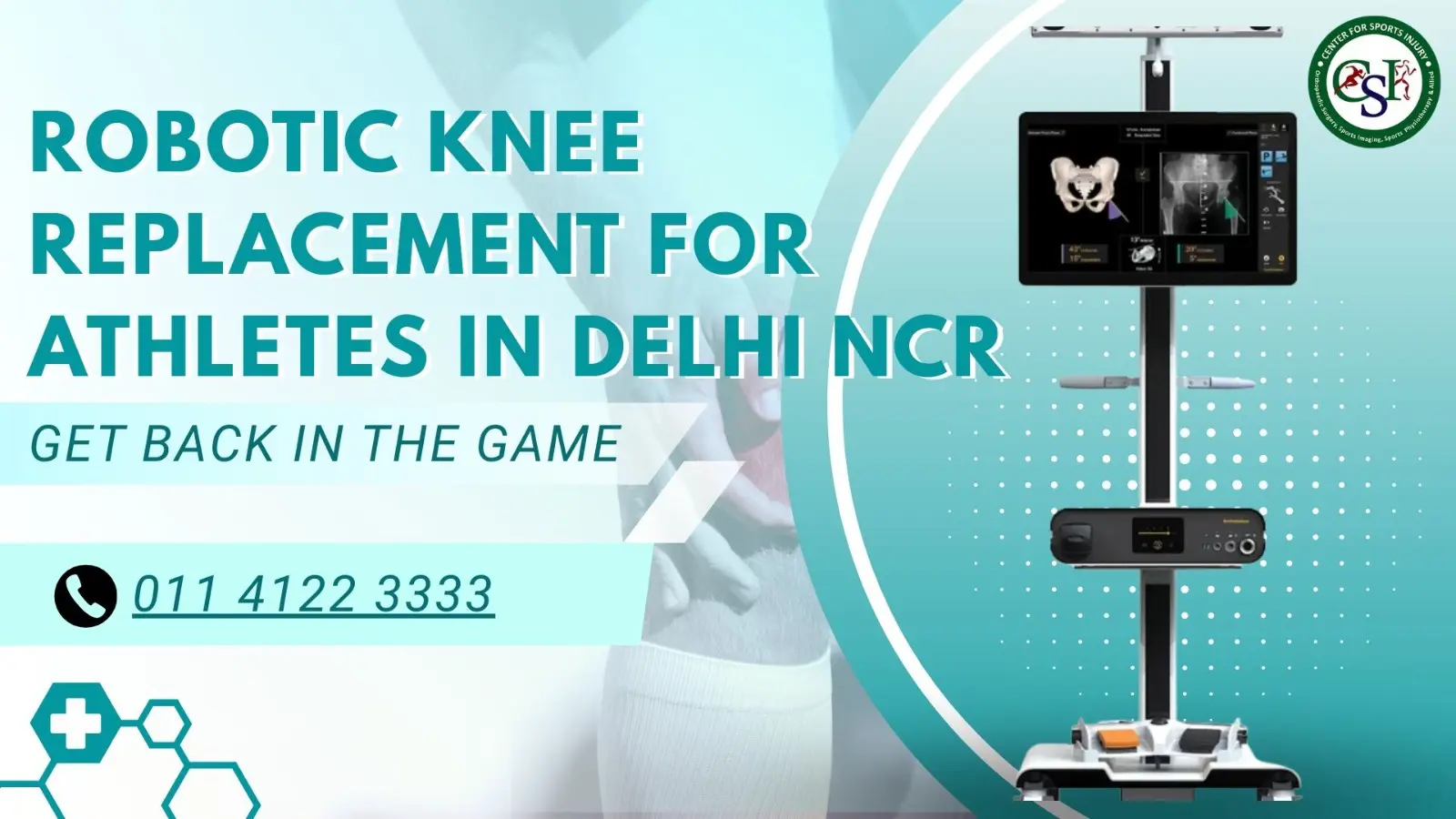 Robotic Knee Replacement for Athletes: A Faster Way Back to the Field in Delhi NCR