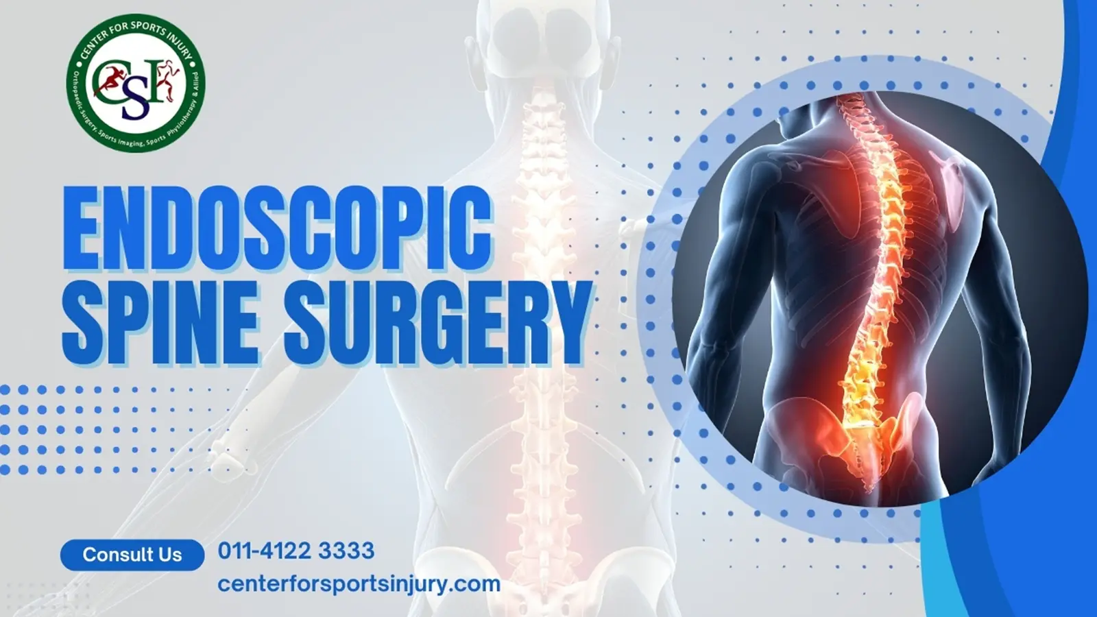 Endoscopic Spine Surgery : A Modern Approach to Treating Spine Disorders
