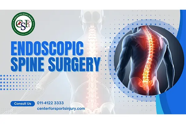 Endoscopic Spine Surgery : A Modern Approach to Treating Spine Disorders