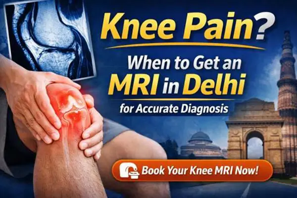 Knee Pain? When to Get an MRI in Delhi for Accurate Diagnosis