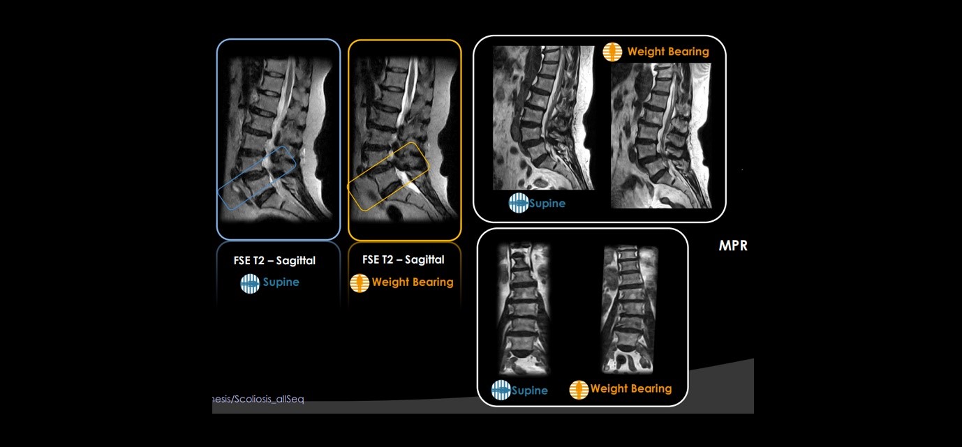 DYNAMIC MRI SEQUENCES