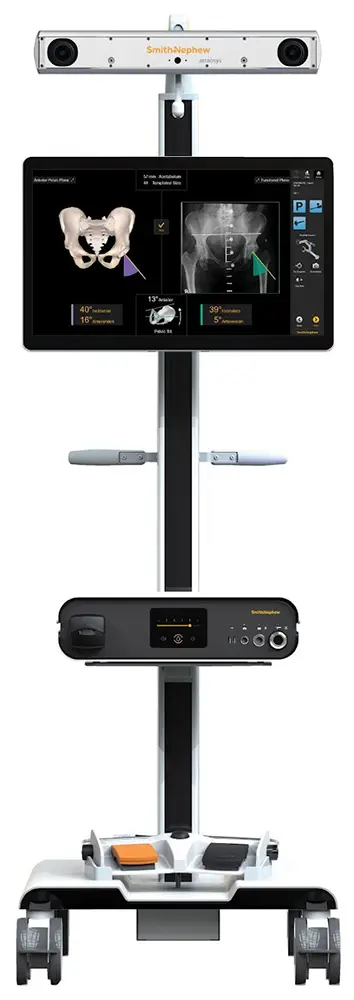 Robotic Knee Replacement Surgery