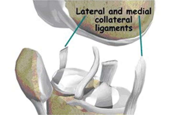 Knee Arthroscopy & ACL Surgery