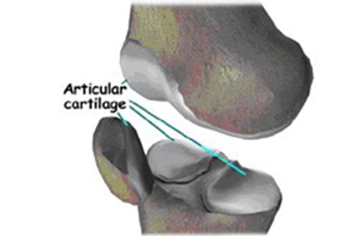 Knee Arthroscopy & ACL Surgery