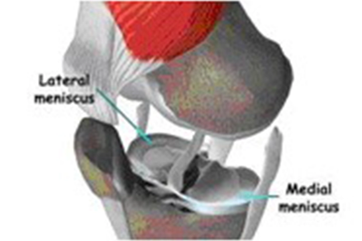 Knee Arthroscopy & ACL Surgery