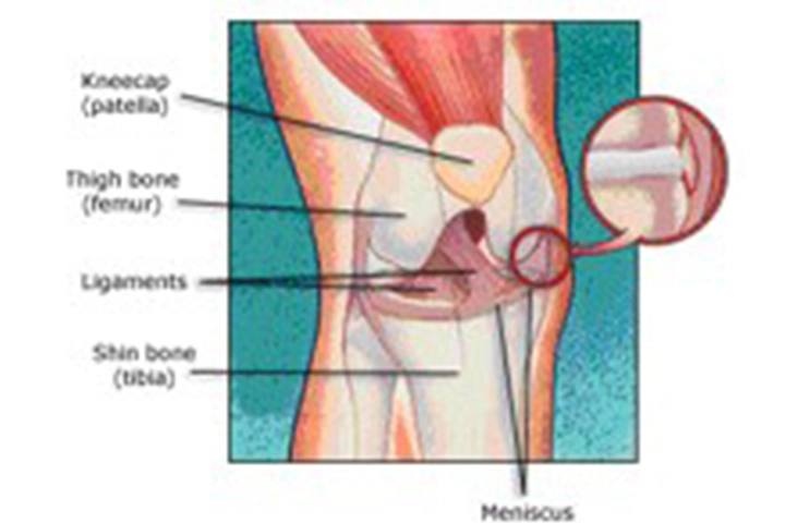 Knee Arthroscopy & ACL Surgery