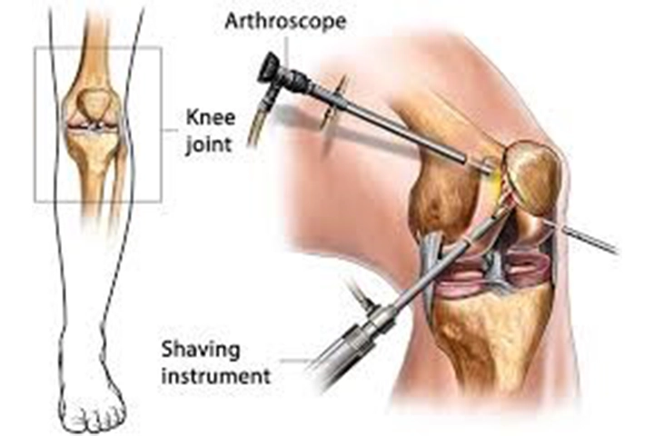 Surgical Procedures