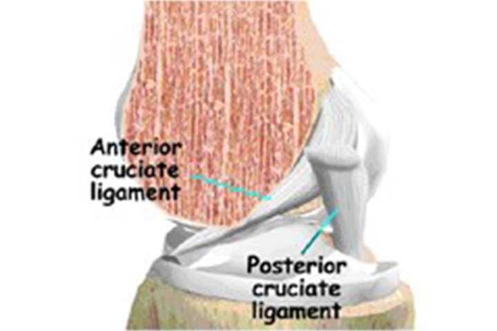 MIS Knee Replacement Surgery