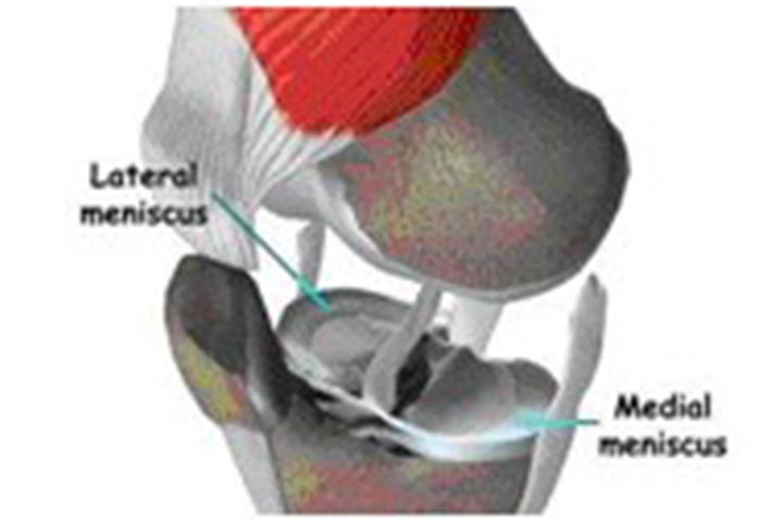 MIS Knee Replacement Surgery