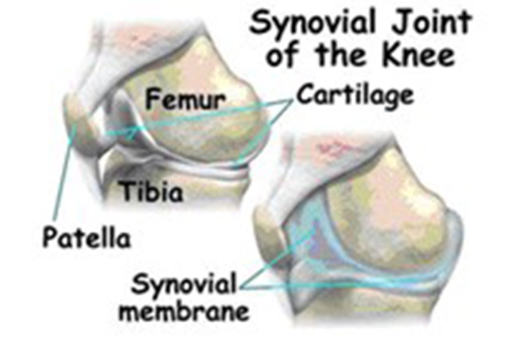 MIS Knee Replacement Surgery