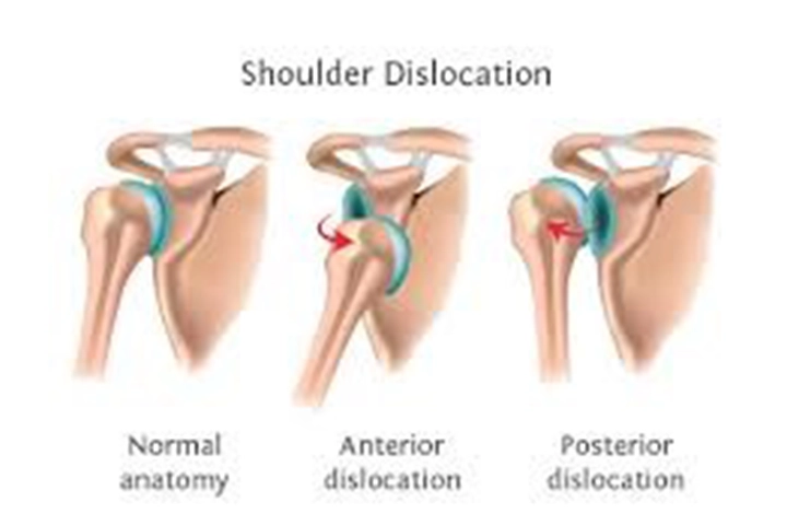 Surgical Procedures