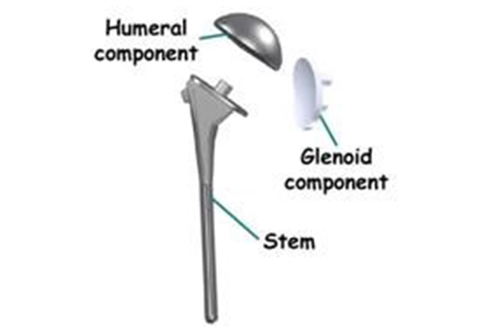 Knee Arthroscopy & ACL Surgery